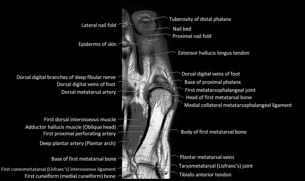 Great Toe micro anatomy MRI axial cross sectional 3T image 12.webp